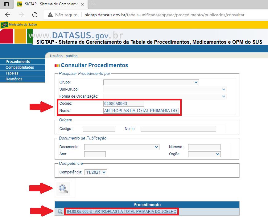 Imagem 1: Tela de pesquisa no SIGTAP